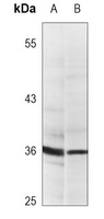 PCNA Antibody [KO/KD Validated]