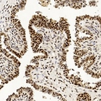PCNA Antibody [KO/KD Validated]