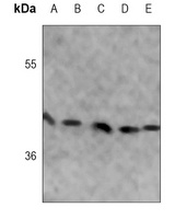 ALDOC Mouse Monoclonal Antibody