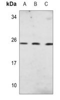 PGP9.5 Mouse Monoclonal Antibody