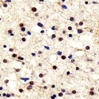 PGP9.5 Mouse Monoclonal Antibody