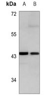 Cytokeratin 19 Mouse Monoclonal Antibody