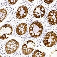 Cytokeratin 19 Mouse Monoclonal Antibody