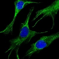Cytokeratin 19 Mouse Monoclonal Antibody