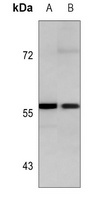 HCK Mouse Monoclonal Antibody