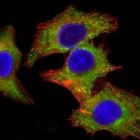 HCK Mouse Monoclonal Antibody