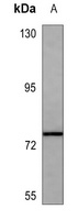 MMP2 Mouse Monoclonal Antibody