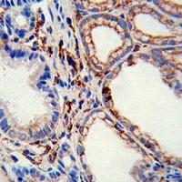 MMP2 Mouse Monoclonal Antibody