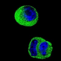MMP2 Mouse Monoclonal Antibody