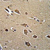 CD271 Mouse Monoclonal Antibody