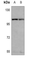 SP1 Mouse Monoclonal Antibody