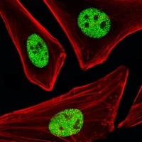 SP1 Mouse Monoclonal Antibody
