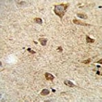 RET Mouse Monoclonal Antibody