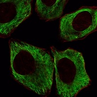 Beta5-tubulin Mouse Monoclonal Antibody