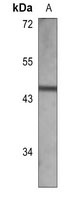 Cathepsin D Mouse Monoclonal Antibody