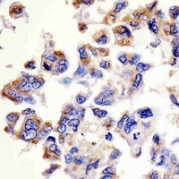 Cathepsin D Mouse Monoclonal Antibody