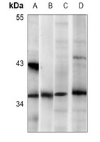 Nucleophosmin Mouse Monoclonal Antibody