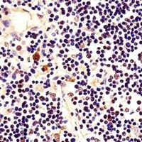 Nucleophosmin Mouse Monoclonal Antibody