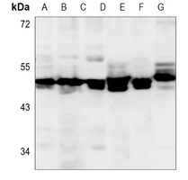 Alpha-enolase Mouse Monoclonal Antibody