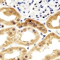 Alpha-enolase Mouse Monoclonal Antibody