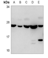 EIF4E Mouse Monoclonal Antibody