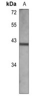 LCK Mouse Monoclonal Antibody