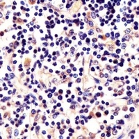 LCK Mouse Monoclonal Antibody