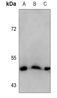 Cytokeratin 18 Mouse Monoclonal Antibody