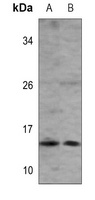 ISG15 Mouse Monoclonal Antibody