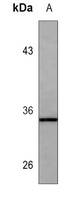 Von Willebrand Factor Mouse Monoclonal Antibody
