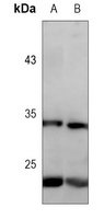 CD74 Mouse Monoclonal Antibody