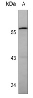 GBA Mouse Monoclonal Antibody