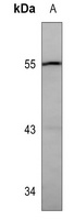 Catalase Mouse Monoclonal Antibody