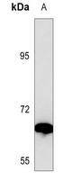 Vitronectin Mouse Monoclonal Antibody
