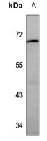 Lactoferrin Mouse Monoclonal Antibody