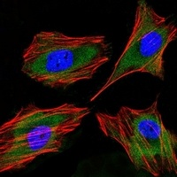 Lactoferrin Mouse Monoclonal Antibody
