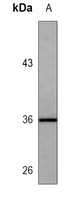 IL-1 beta Mouse Monoclonal Antibody