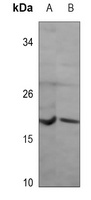 NRAS Antibody [KO/KD Validated]