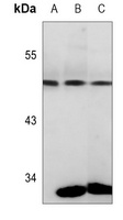 PGK1 Antibody [KO/KD Validated]