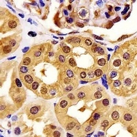 PGK1 Antibody [KO/KD Validated]