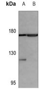 EGFR Mouse Monoclonal Antibody