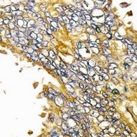 EGFR Mouse Monoclonal Antibody