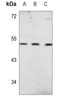 PAH Mouse Monoclonal Antibody