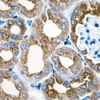 PAH Mouse Monoclonal Antibody