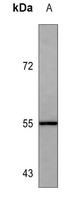 ALDH1A1 Mouse Monoclonal Antibody