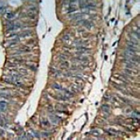 ALDH1A1 Mouse Monoclonal Antibody