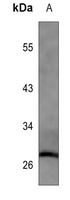 BCL10 Antibody [KO/KD Validated]