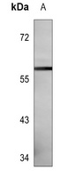 CNOT4 Antibody [KO/KD Validated]