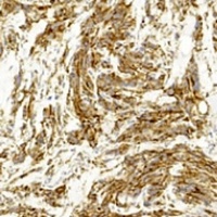 MITF Mouse Monoclonal Antibody