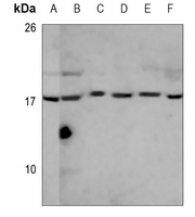 EEF1E1 Mouse Monoclonal Antibody